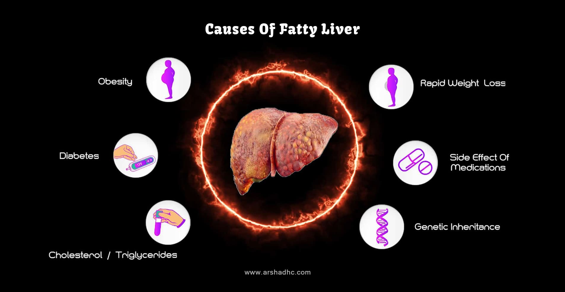 Illustration showing the causes of fatty liver