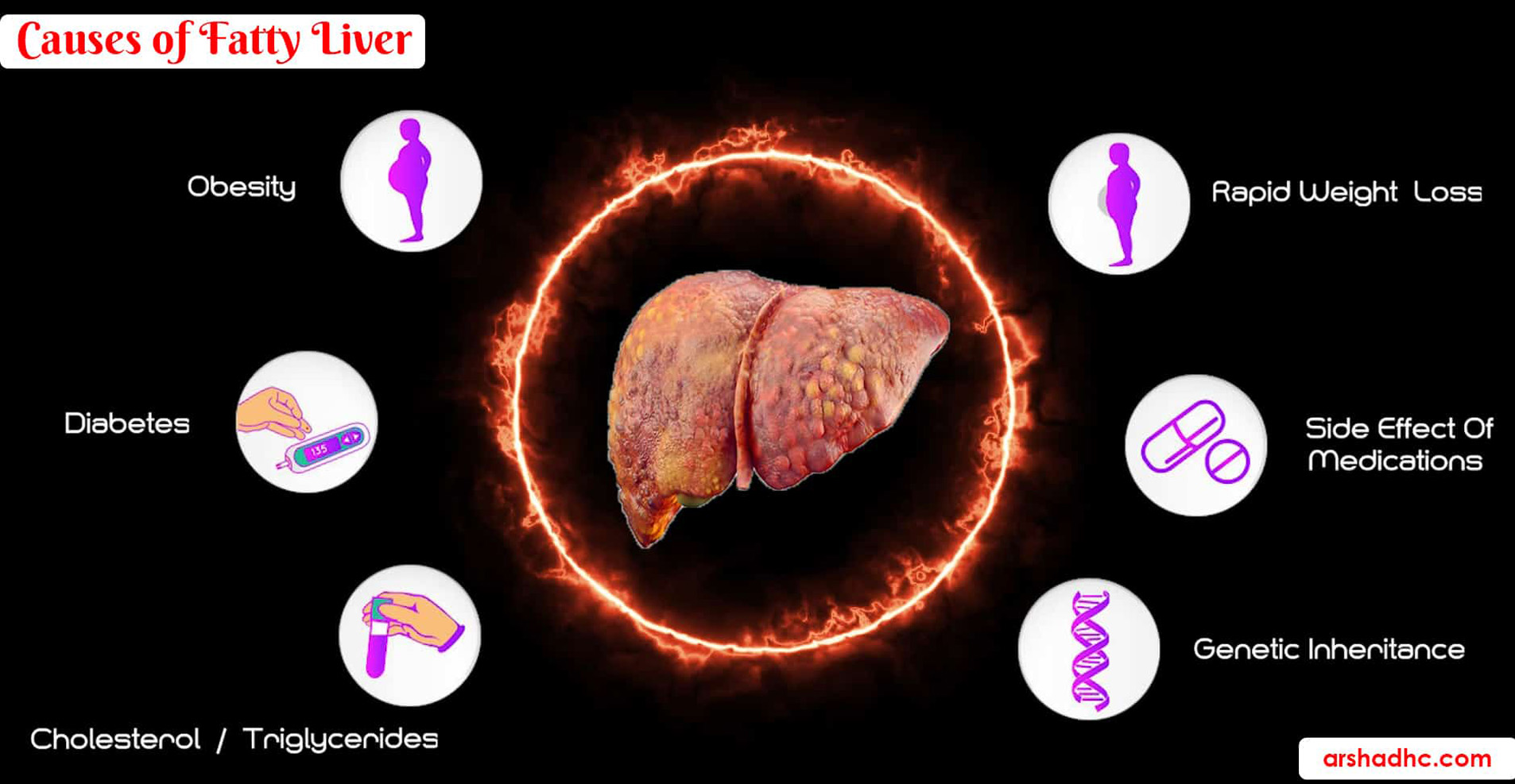 Common causes of fatty liver disease