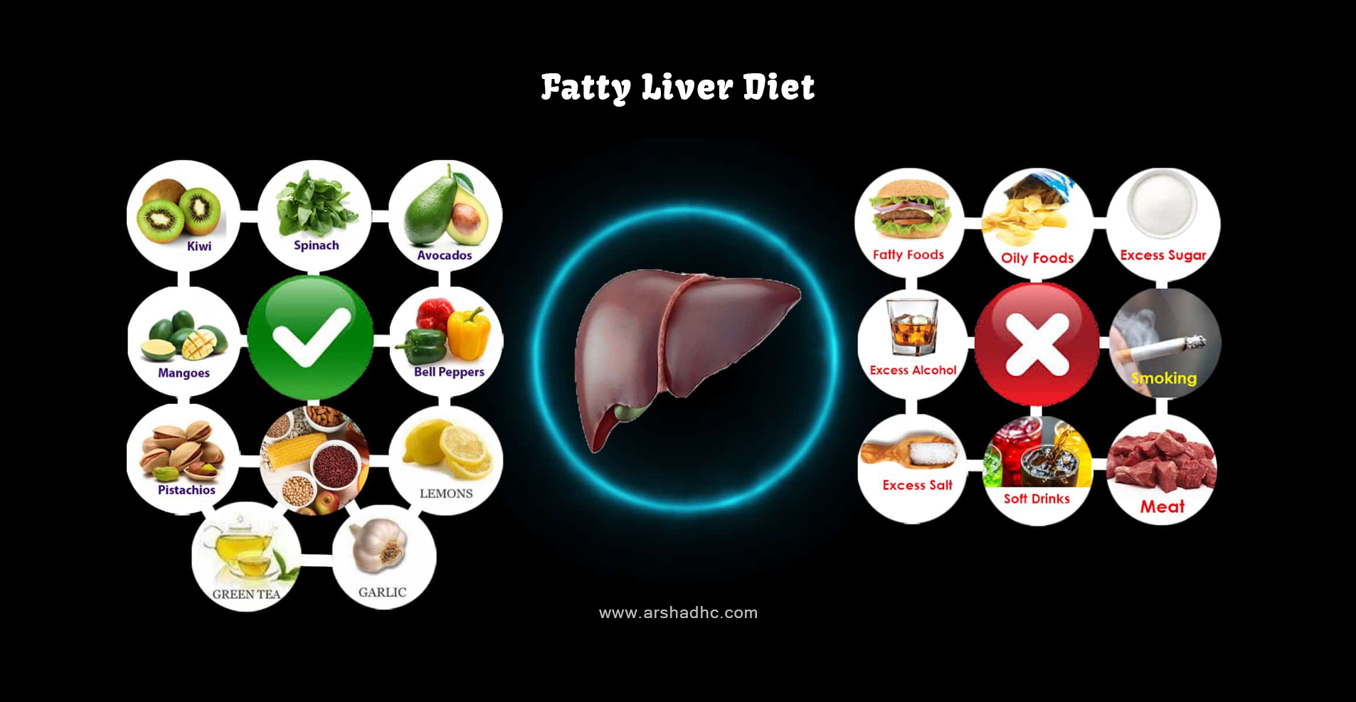 Illustration showing the causes of fatty liver