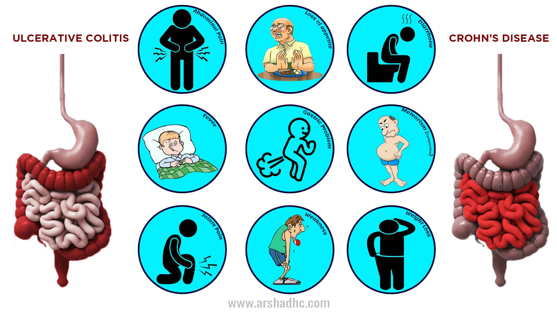 ibd symptoms