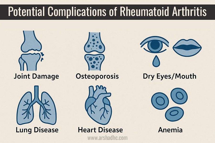 Potential complications of rheumatoid arthritis