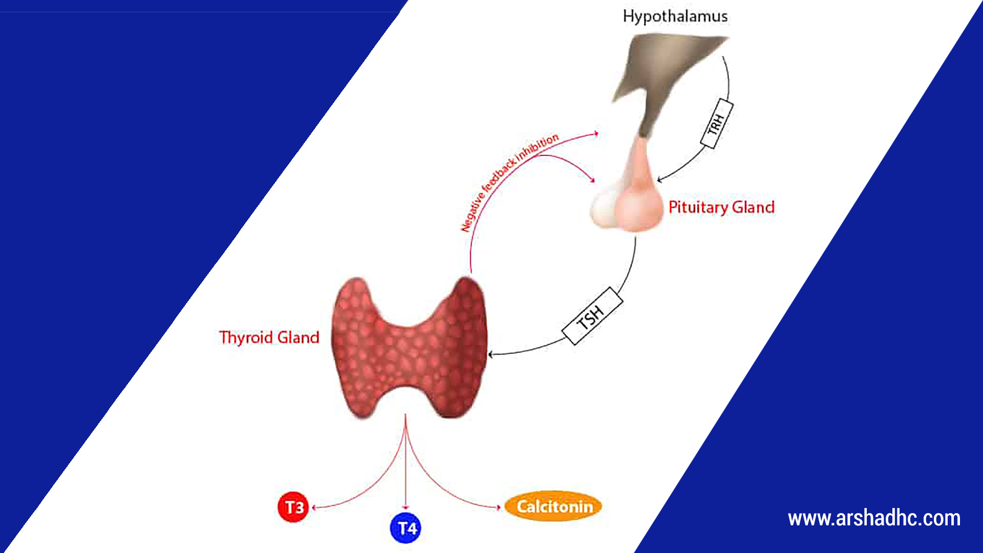 Thyroids